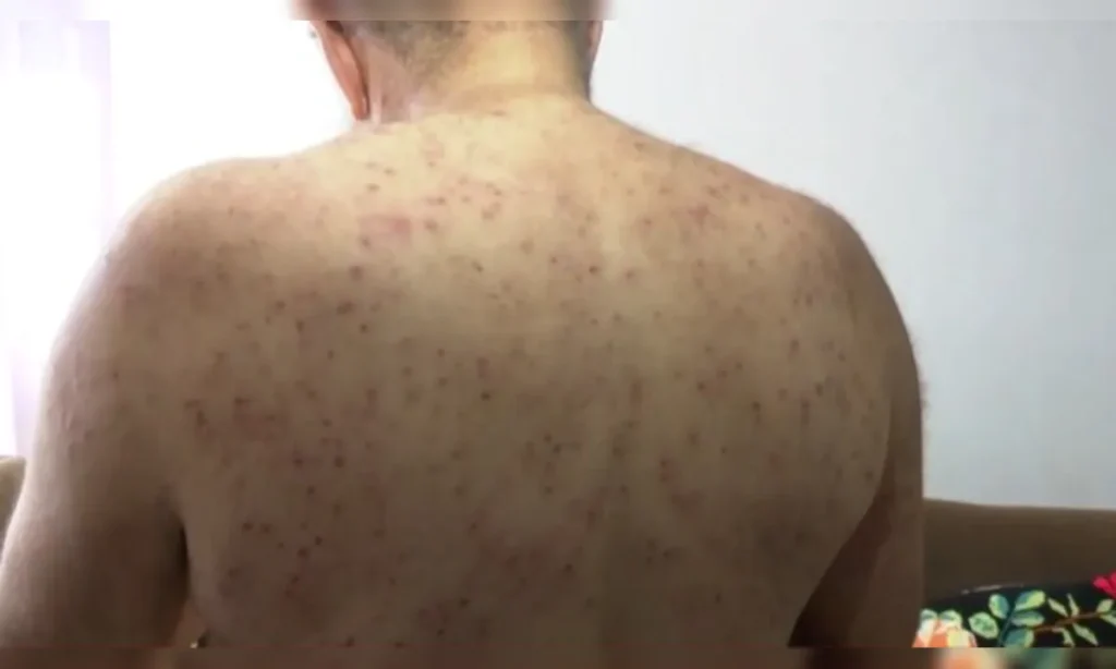 “Mil picadas de abelha: como um idoso paranaense sobreviveu?”